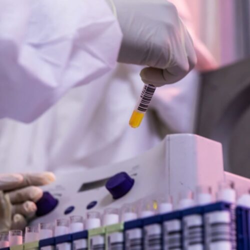 A lab worker examines specimens in test tubes.